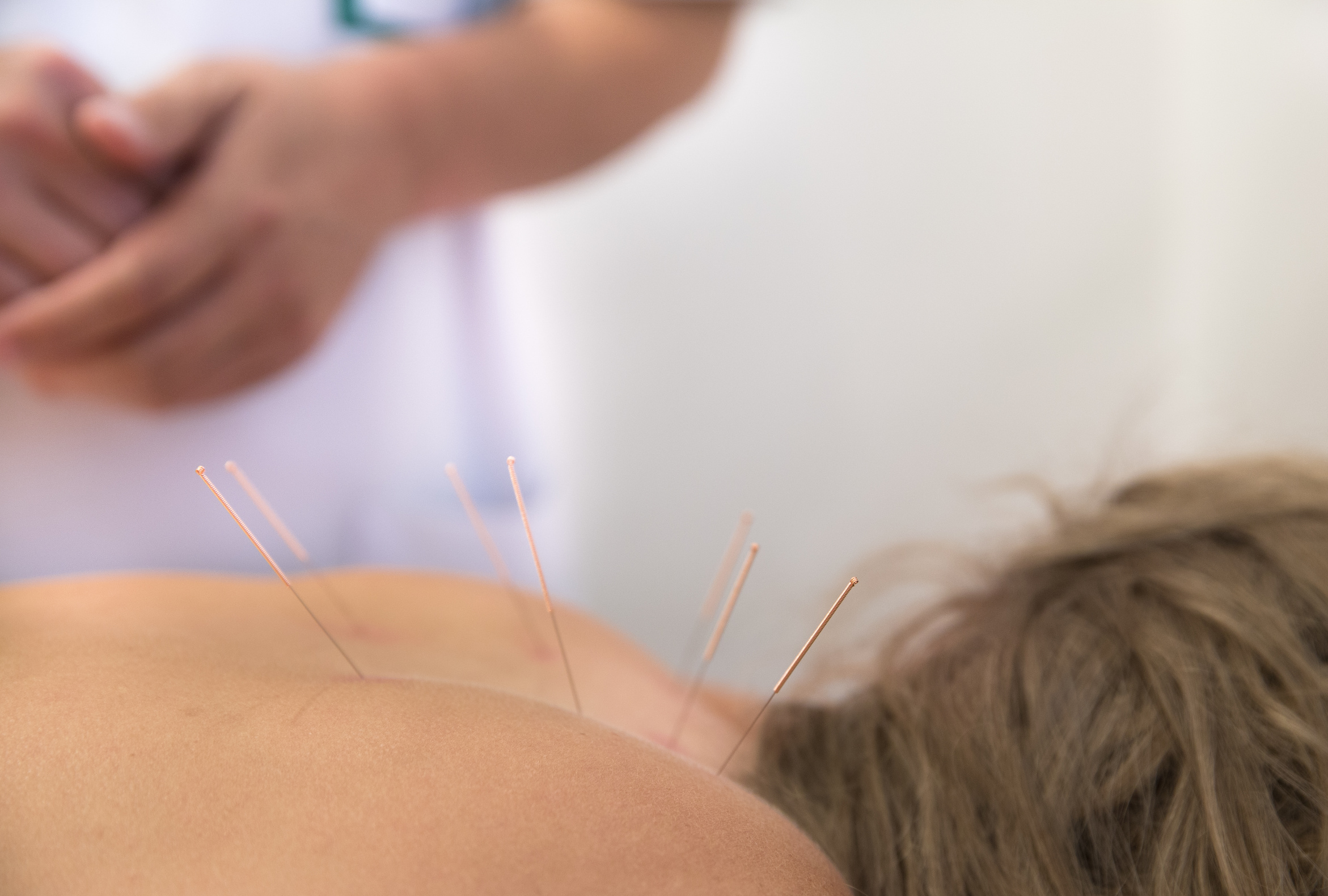 Utilidad de la acupuntura en el dolor crónico de origen